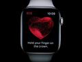 post_big/ECG-patent-infringement-claim.jpg