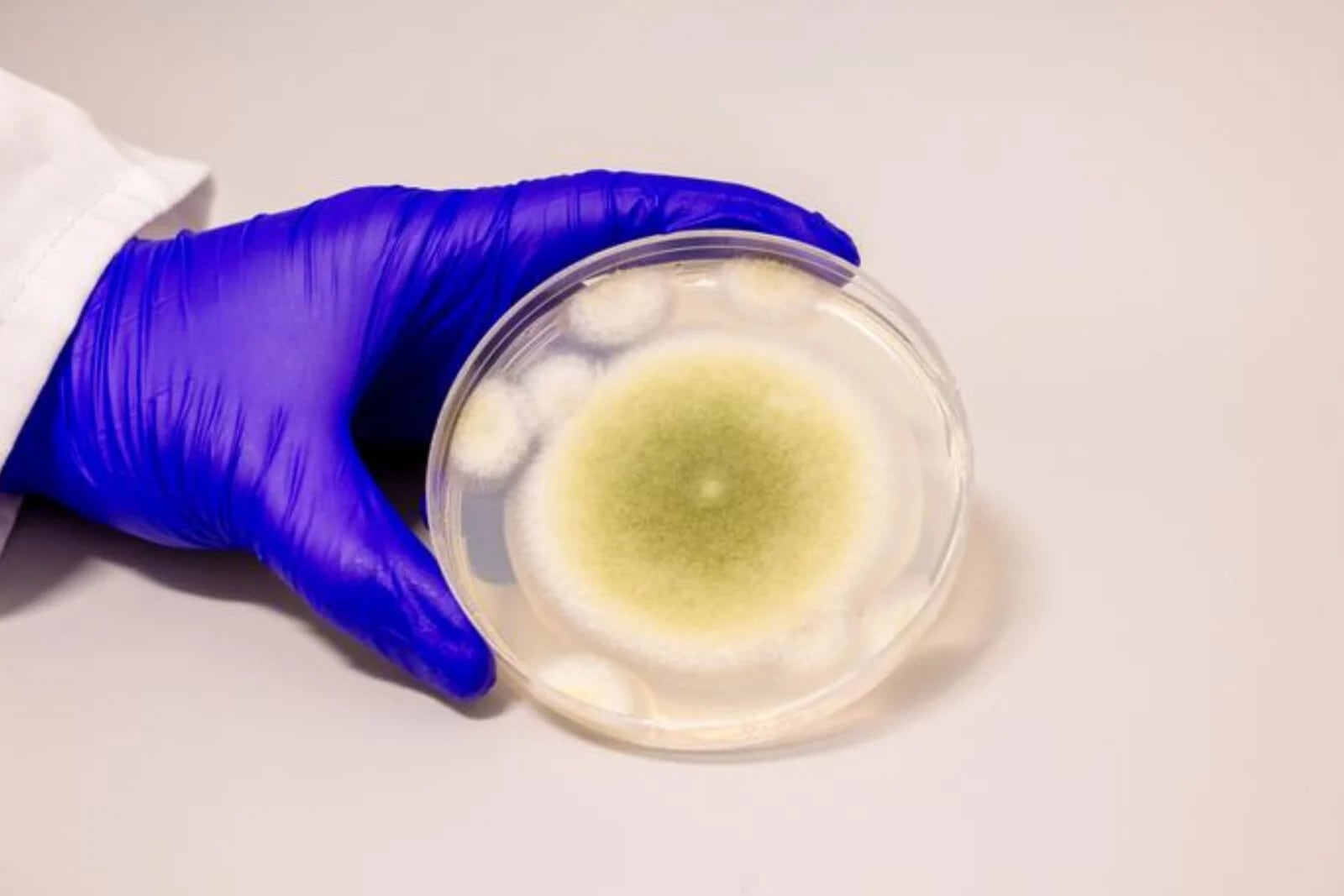 Aspergillus flavus : innovations potentielles et risques pour la santé Aspergillus flavus : un champignon avec un potentiel technologique et des défis