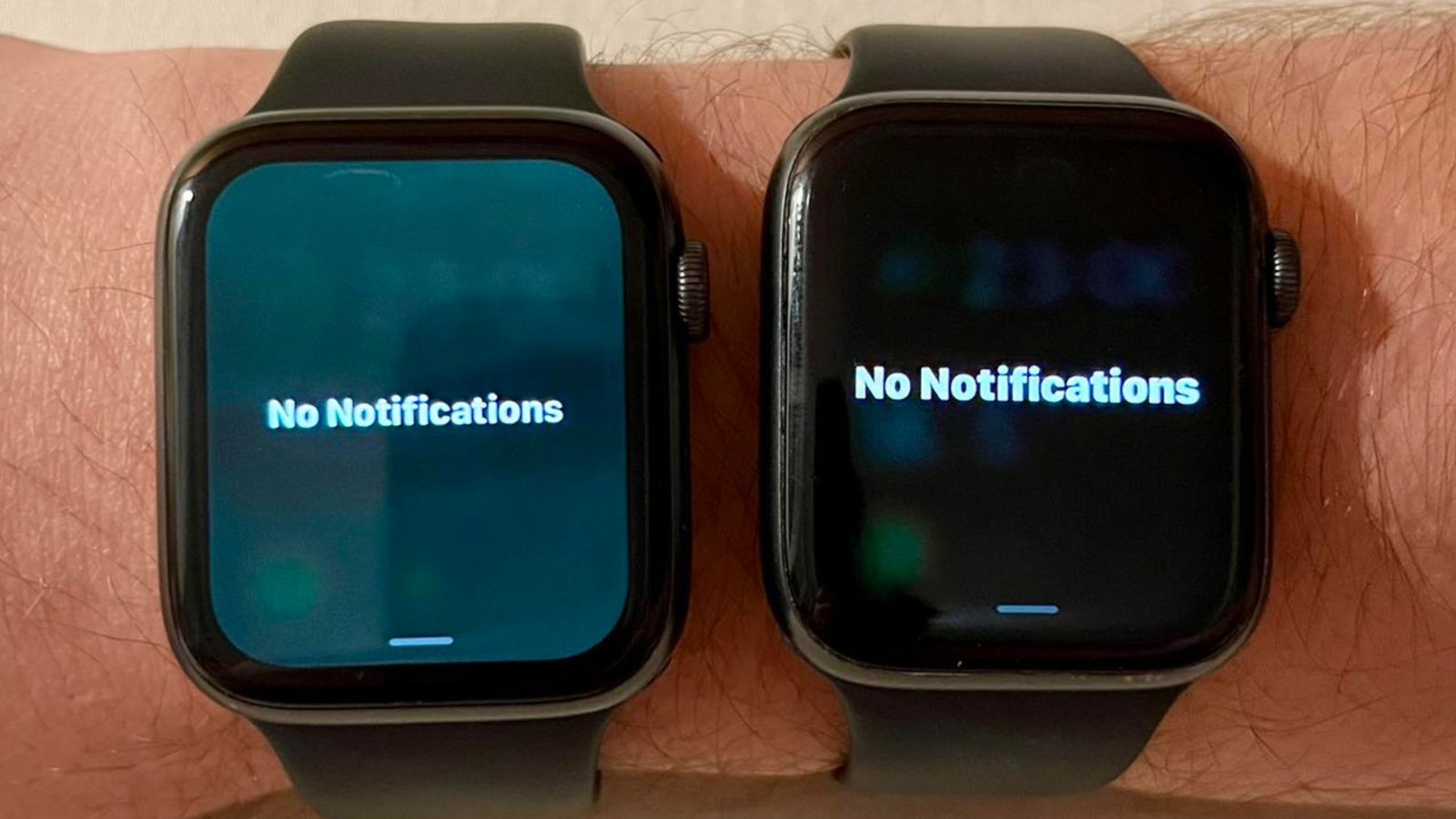 Certaines Apple Watch sont devenues "vertes" après la mise à jour vers watchOS 9.5 Certaines Apple Watch sont devenues "vertes" après la mise à jour vers watchOS 9.5